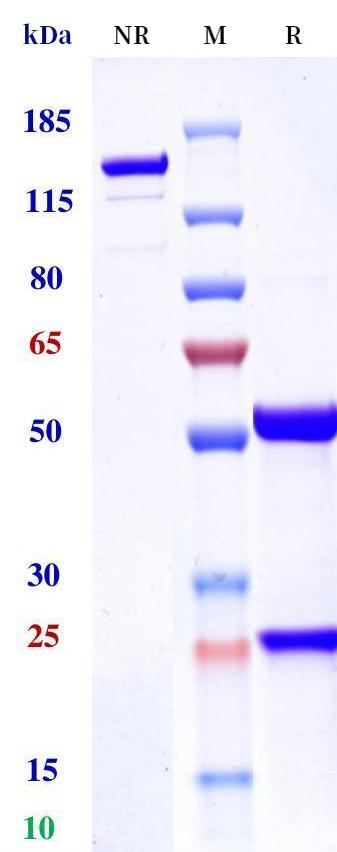 0 - Anti-Monkeypox virus/MPXV A29L Mouse Antibody (B147) APR11103