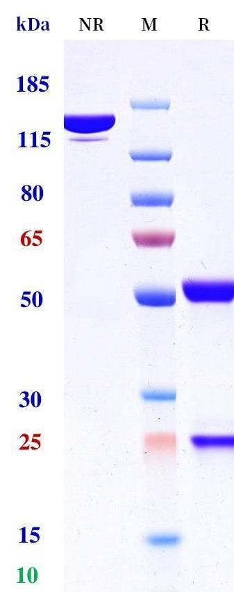 0 - Anti-GPR64 / ADGRG2 Reference Antibody (Facet patent anti-GPR64) APR11156