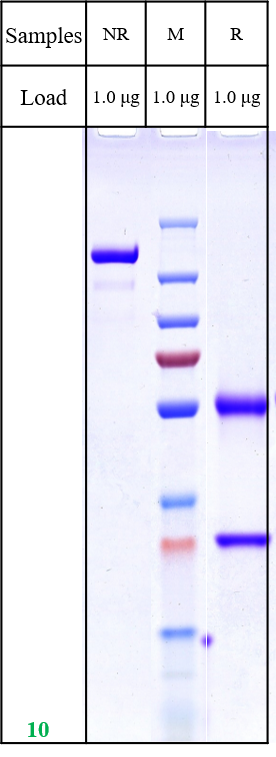 0 - Anti-LIV-1 / SLC39A6 Mouse Antibody APR11161