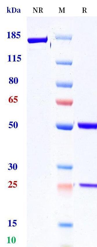 0 - Anti-IL-1RA Reference Antibody (CNRS patent anti-IL-1RA) APR11355