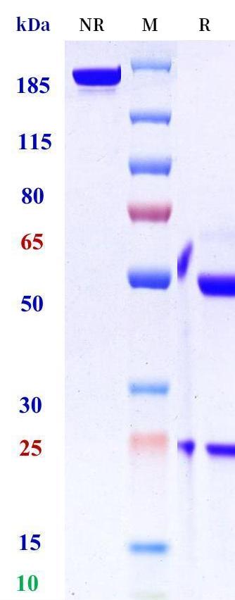 0 - Anti-MSR1 Reference Antibody (Regeneron patent anti-MSR1) APR11375