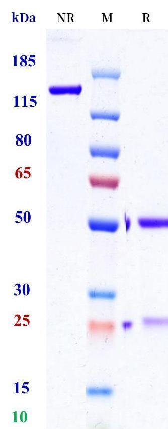 0 - Anti-CD1a Reference Antibody (U.Oxford patent anti-CD1a) APR11414