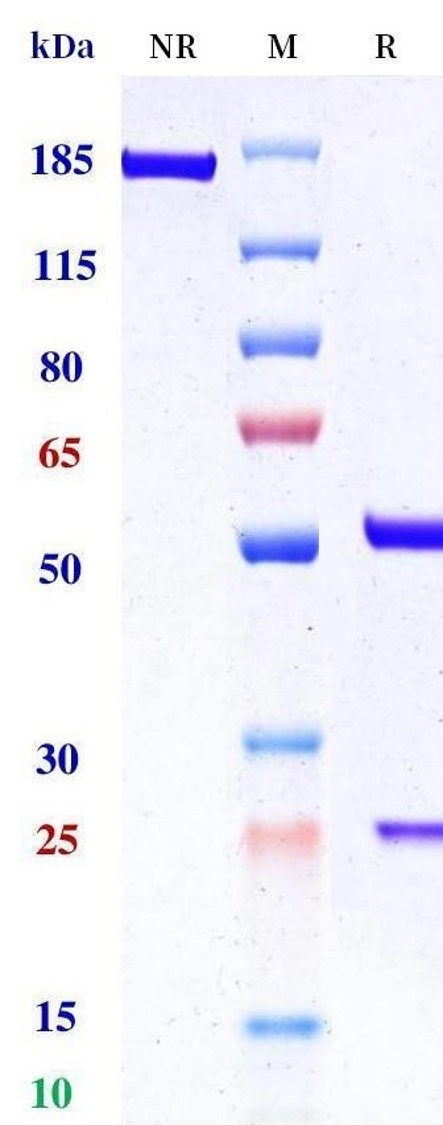 0 - Anti-IL-18BP Reference Antibody (Novartis patent anti-IL-18) APR11464