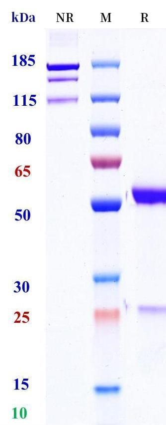 0 - Anti-TIMP1 Reference Antibody (Bayer patent anti-TIMP-1) APR11543