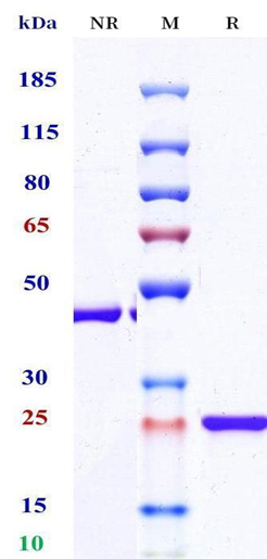0 - Anti-Nipah virus Glycoprotein G （m102.3） APR11677