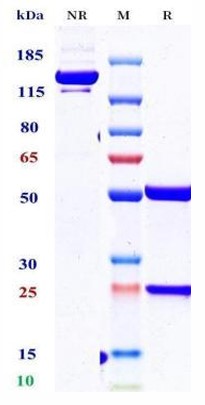 0 - Anti-S100A4 Reference Antibody (AX-202) APR11704