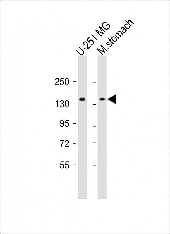 1 - Mouse Cdk13 Antibody (N-term) AP14952a