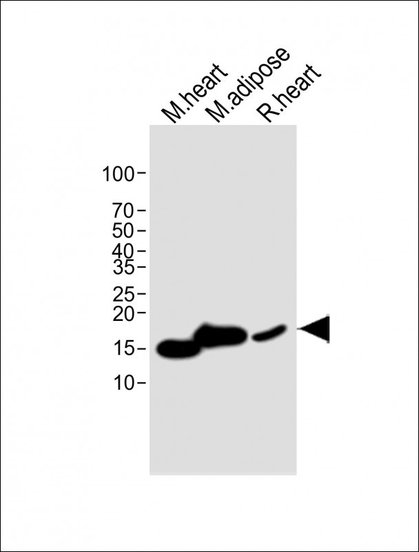 1 - FABP4(Y20) Antibody AP22495a