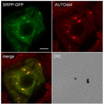 0 - AUTOdot Autophagy Visualization Dye SM1000b